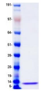 Coomassie blue staining of purified CXCL5 protein.